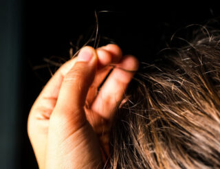 Trichotillomania