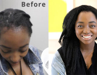 hair clinic testimonial