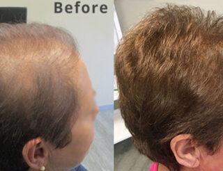 Hair clinic reviews
